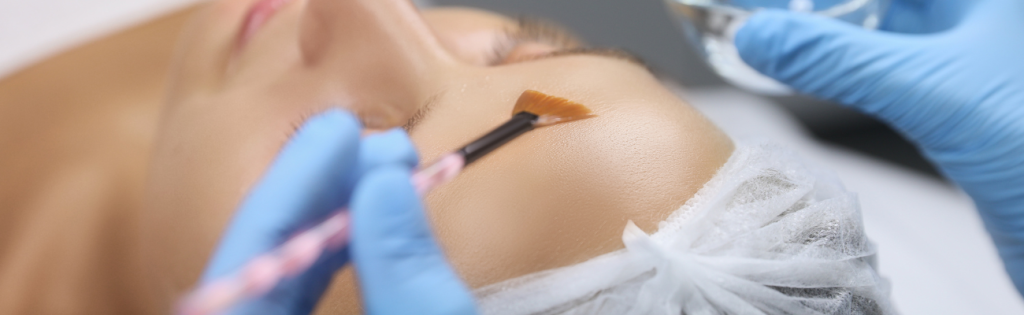 Unravel the Mystery of Chemical Peels: Discover the Perfect Peel for Your Unique Skin Needs! 2 BLOGS 2023 03 25T030659.865