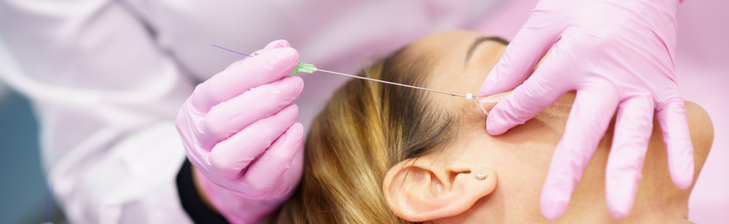 Woman undergoing thread lift treatment for facial rejuvenation in a clinical setting.