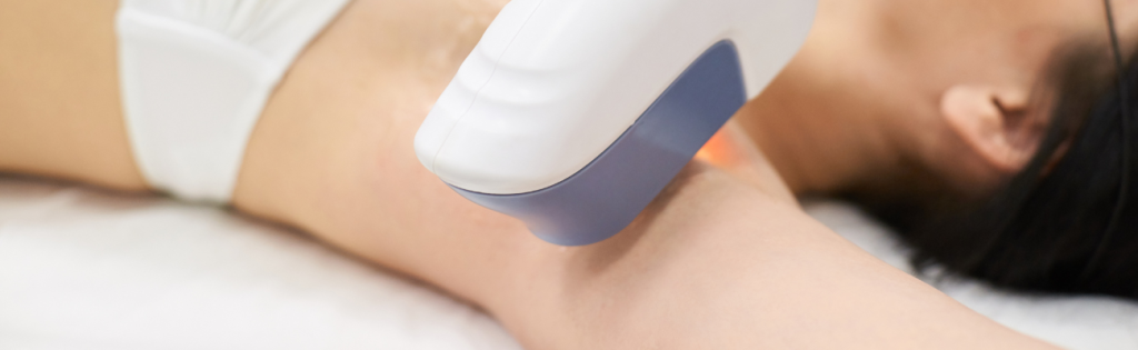 Laser device in use during hair removal treatment on client’s skin.