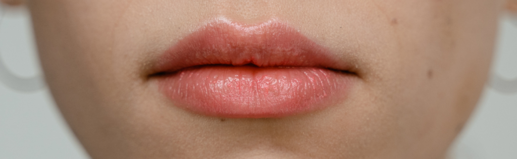 Can Your Body Reject Dermal Fillers? The Astonishing Truth Revealed! 2 BLOGS 1 1