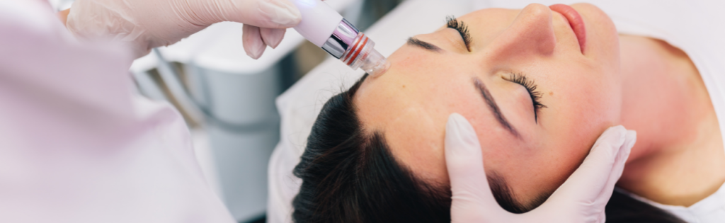 Woman receiving a professional microneedling treatment in a clinic.