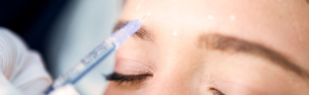 Does Botox Hurt? Unveiling the Truth Behind Botox 1 Close-up of Botox injection for wrinkle reduction on woman’s forehead.