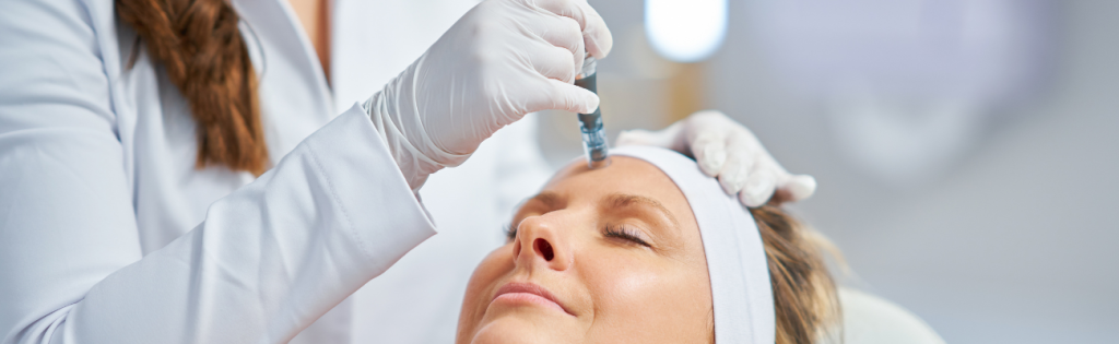 How to Choose the Right Micro-Needling Supplies for Your Clients 1 BLOGS 2023 04 03T182453.818