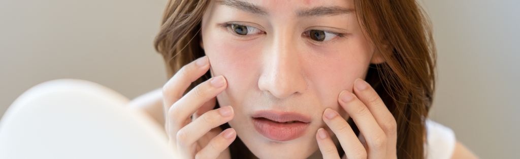 Beware of the Sneaky 6: Unmasking Allergies That Can Wreak Havoc on Aesthetic Treatments! 1 BLOGS 2023 04 15T012506.957