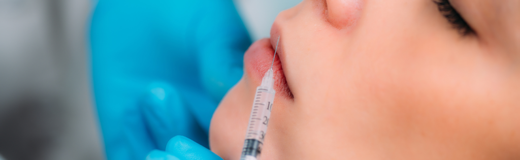 How Do You Know if Your Filler is Bad? Spotting the Warning Signs 2 Close-up of a professional applying a lip filler injection to a client's lips, with gloved hands using a syringe for cosmetic enhancement.