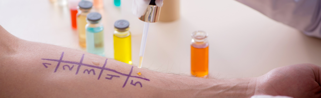 What Treatments Require a Patch Test? A Comprehensive Guide 2 BLOGS 25