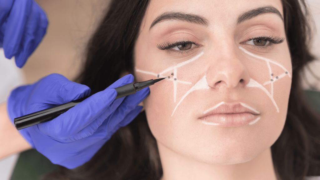 Aesthetic practitioner mapping a client’s face with a white pencil before a cosmetic treatment in a clinical setting.