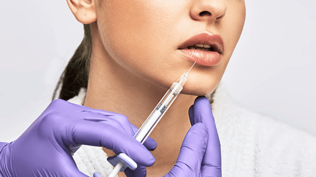 How Do You Know if Your Filler is Bad? Spotting the Warning Signs 1 Close-up of a woman receiving a cosmetic lip injection, with a professional in purple gloves carefully administering the procedure using a syringe.