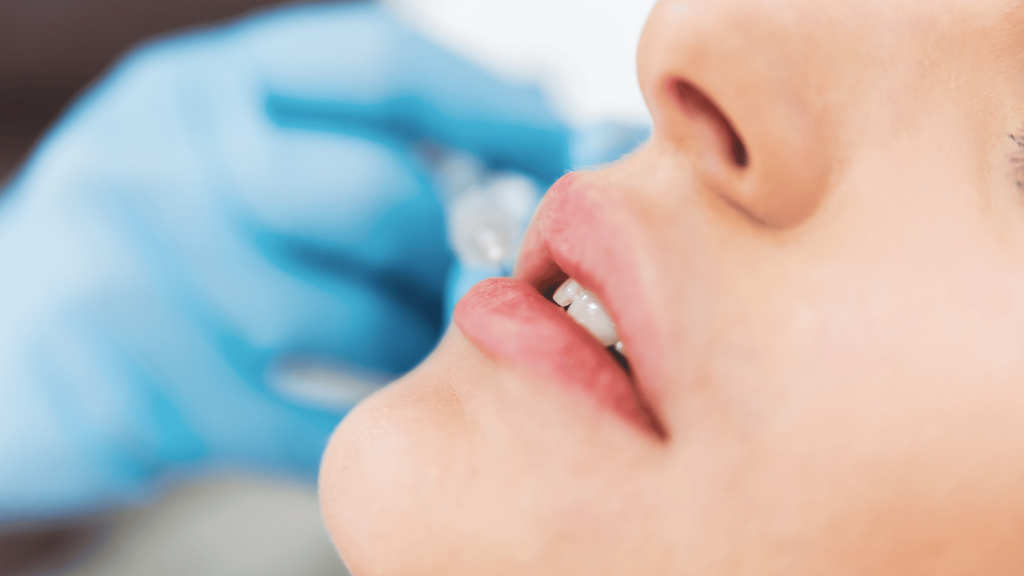 Lip Fillers in the UK: What You Need to Know About This Popular Cosmetic Procedure 1 Woman receiving dermal filler injections in a clinic to restore volume and enhance facial contours.