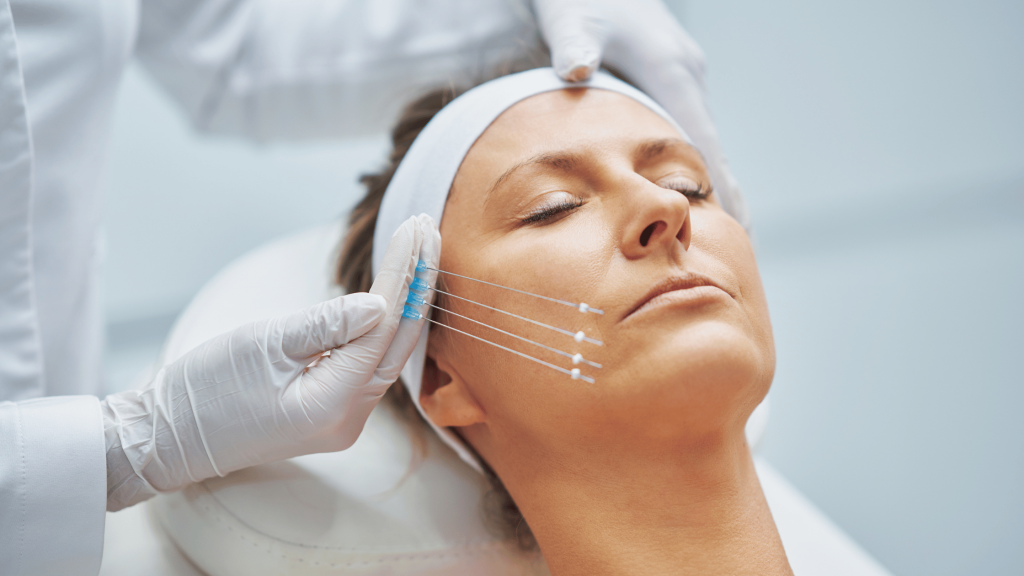 One Session, Multiple Treatments: Smart or Risky? 1 Client receiving a PDO thread lift from a qualified aesthetic practitioner.