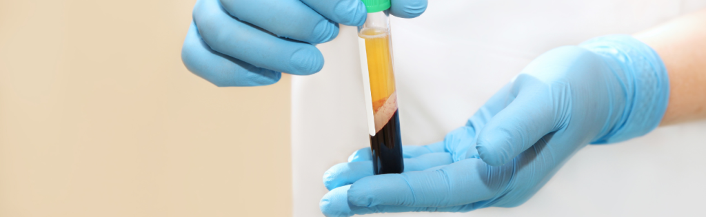 Faces | Understanding the Longevity of PRP Treatments 2 FACES CONSENT BLOG 19