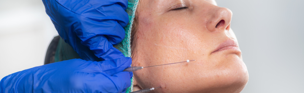 FACES CONSENT BLOG 5