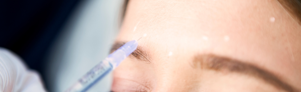 How Treatment Goals and Expectations Are Outlined in a Botox Consent Form 1 FACES CONSENT BLOG 50
