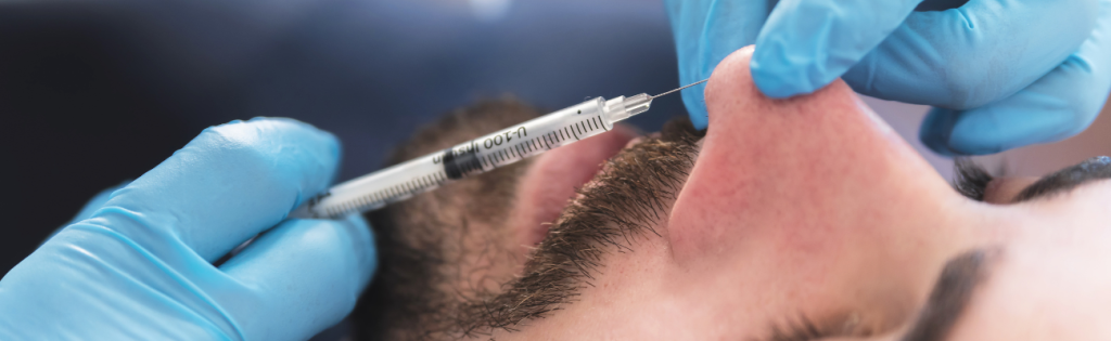 The Rise of Non-Surgical Rhinoplasty and Thread Lifting in the UK 1 Non-Surgical Rhinoplasty Nose Enhancement: A UK Trend in Aesthetic Medicine