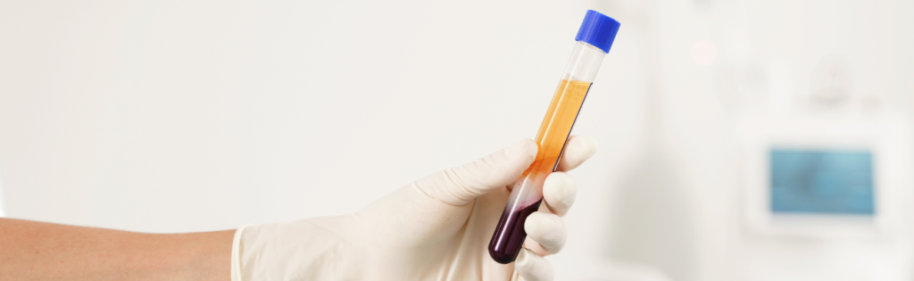 Unveiling the Secrets of the Vampire Facial: A UK Beauty Trend 1 Vampire Facial: Using blood as a facial treatment.