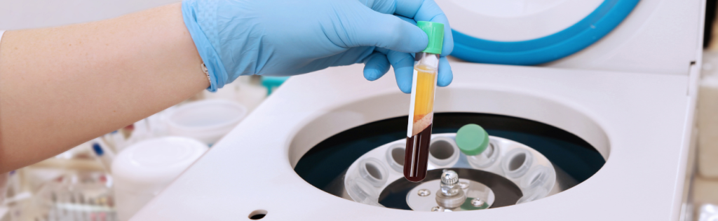 Unveiling the Secrets of the Vampire Facial: A UK Beauty Trend 2 Why vampire facial a hit among UK beauty enthusiasts.