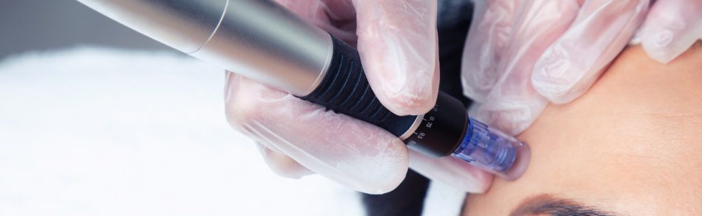 Debunking Common Myths About Insurance in the Beauty Sector 1 An image of a Dermapen, a handheld device used for microneedling treatments. The Dermapen features fine needles and is designed to improve skin texture and appearance through controlled micro-injuries.