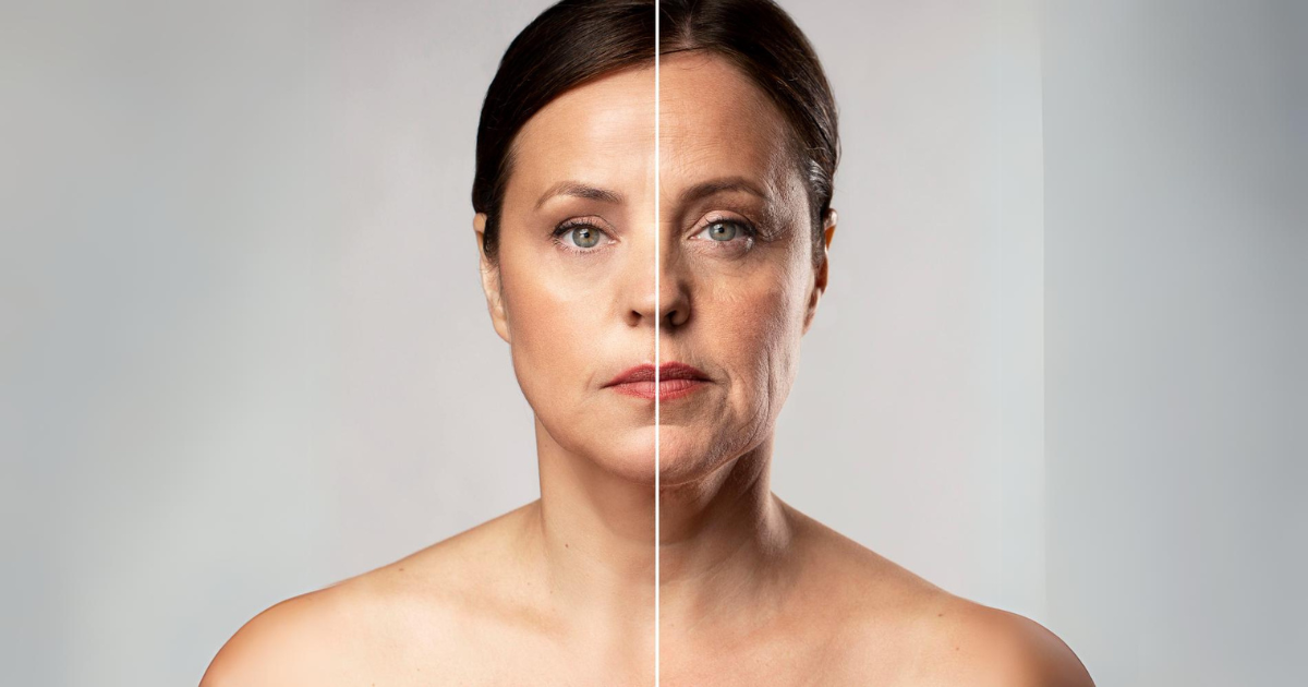 Profhilo Is The #1 Skin Booster For 7 Reasons! 4 Post-Profhilo treatment results: woman with visibly hydrated and radiant skin.