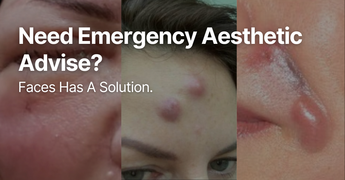 Need Emergency Aesthetic Advise? Faces Has A Solution 1 aesthetic advise